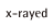 x-rayed